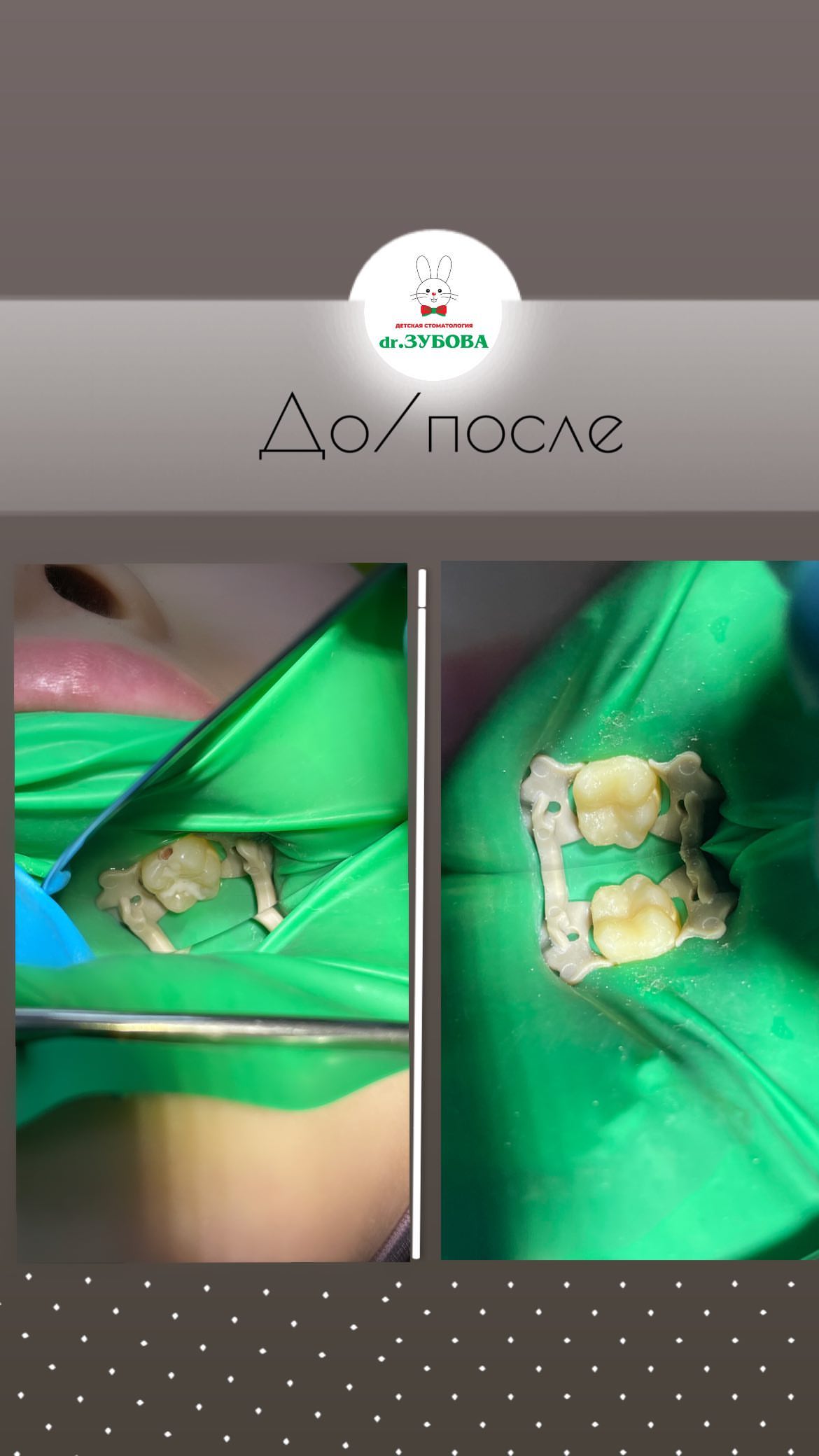 До/После — результат лечения