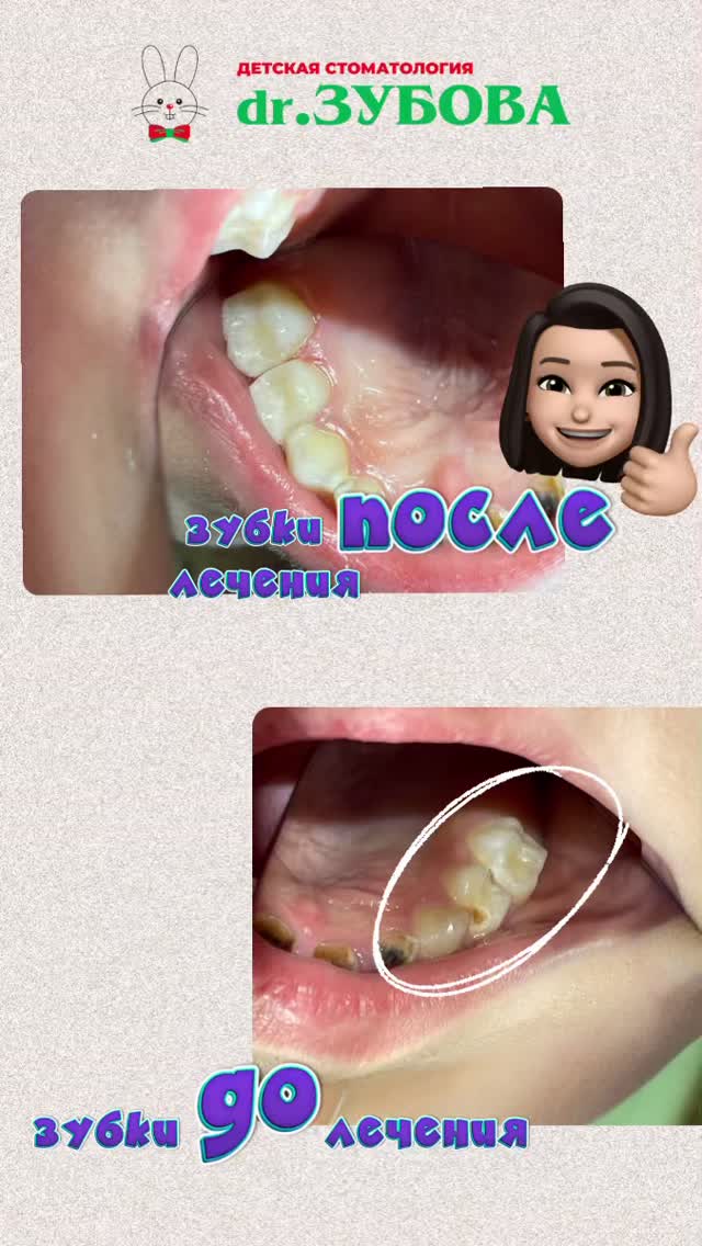До/После — результат лечения