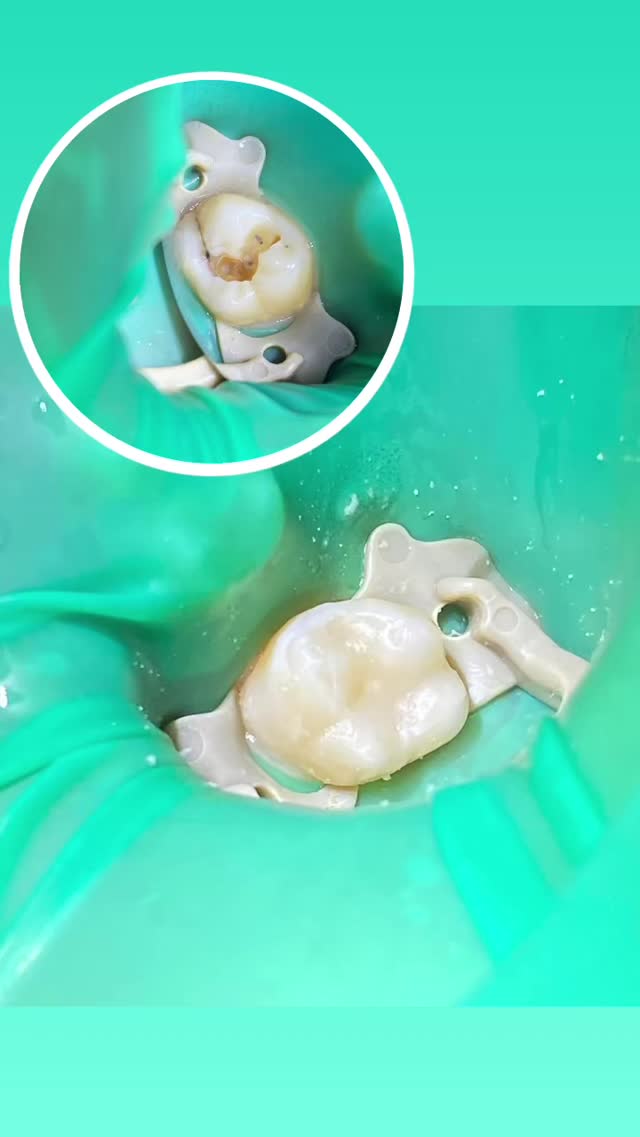 До/После — результат лечения