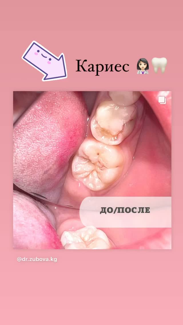 До/После — результат лечения