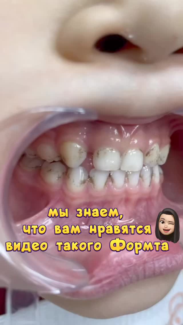 До/После — результат лечения