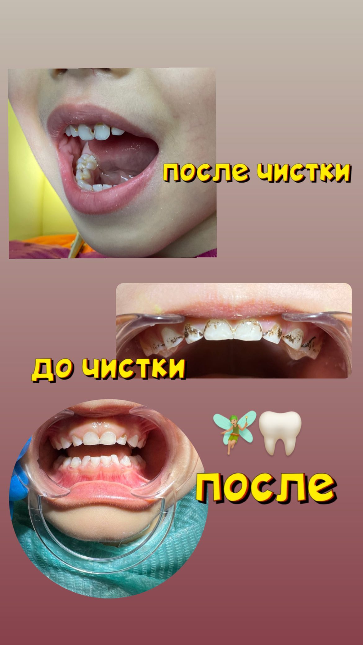 До/После — результат лечения