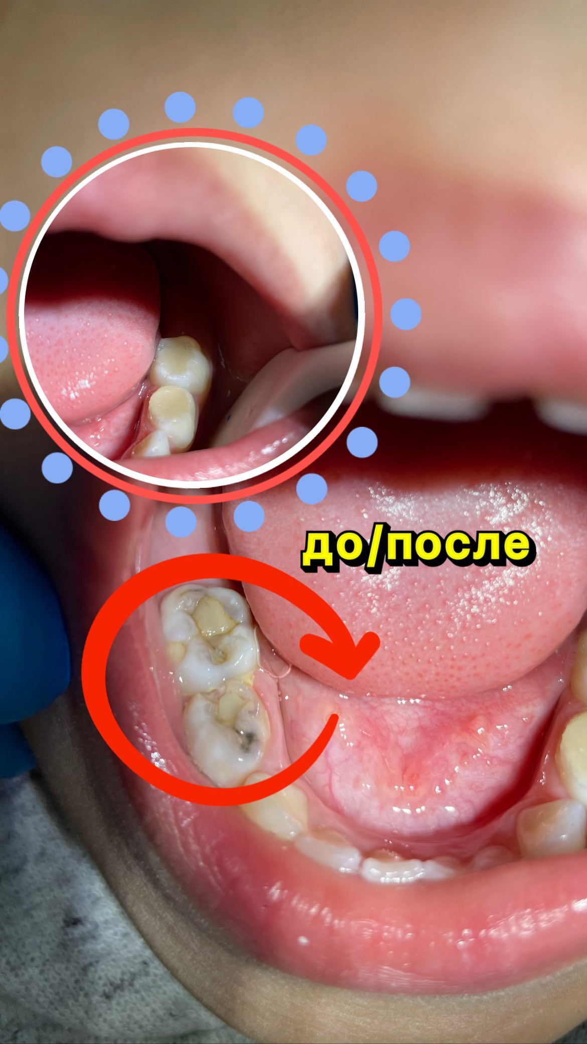 До/После — результат лечения