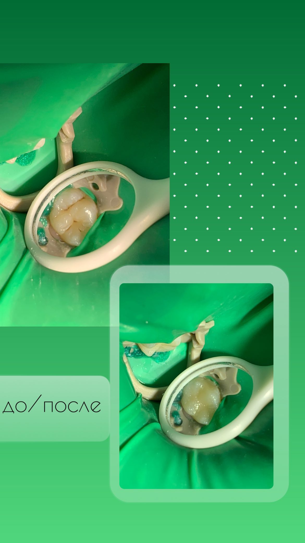 До/После — результат лечения