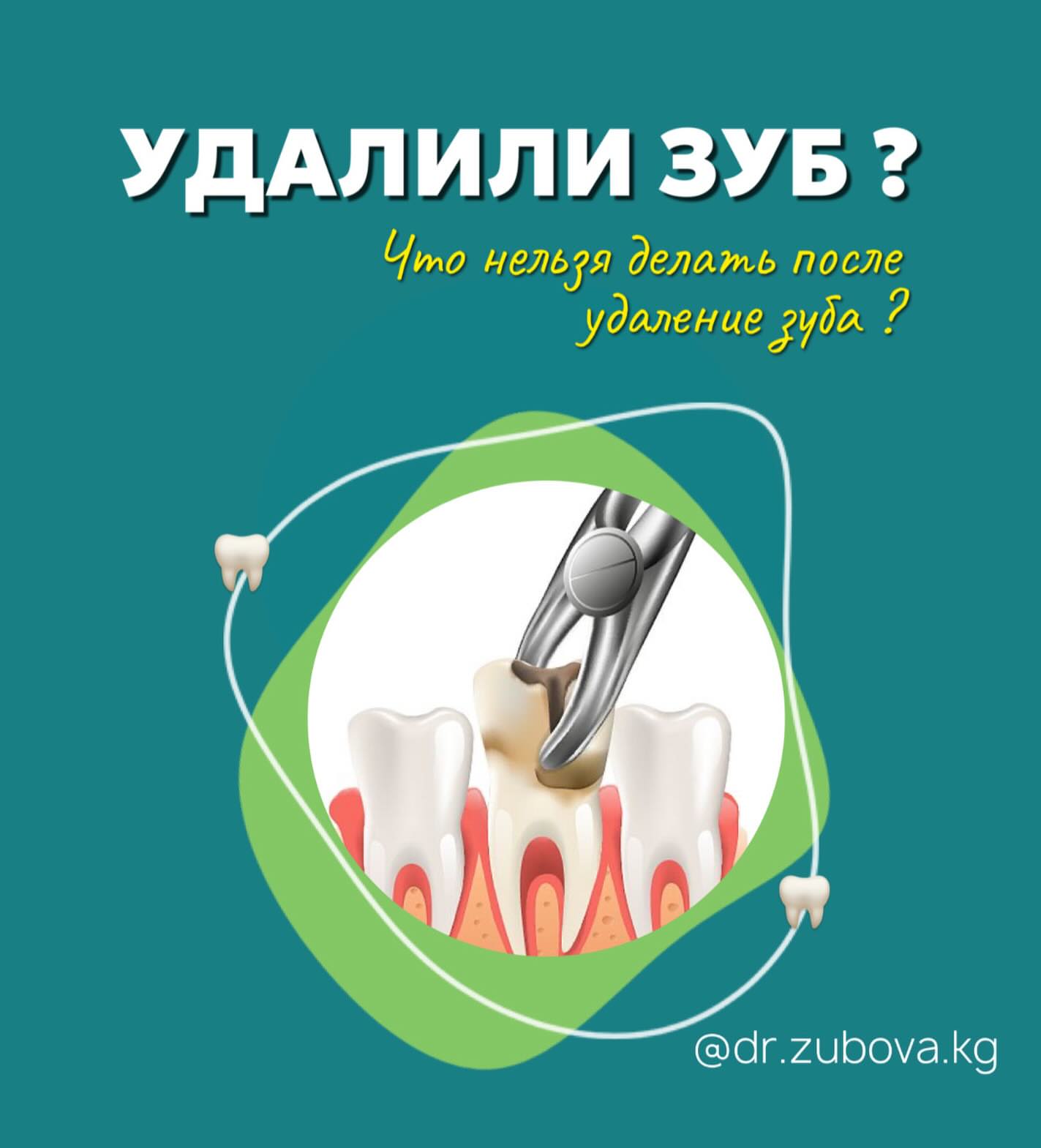 Удаление зубов