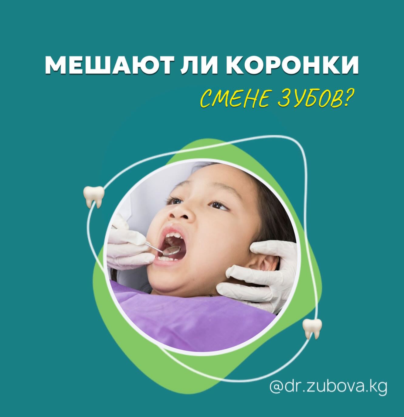 Коронки на молочные зубы